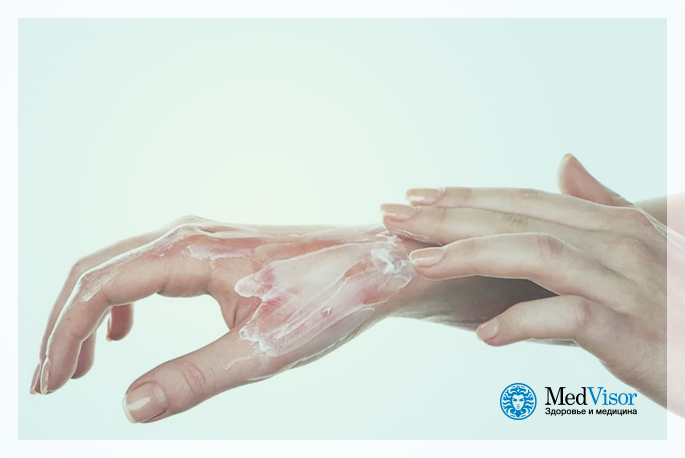 Лечение ожога крапивы В чем польза ожога крапивой