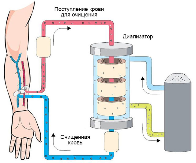 Можно принимать аллопуринол во время приступов подагры Можно принимать аллопуринол во время приступов подагры thumbnail