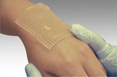 Что будет с кожей при ожоге кратко