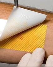 Что будет с кожей при ожоге кратко