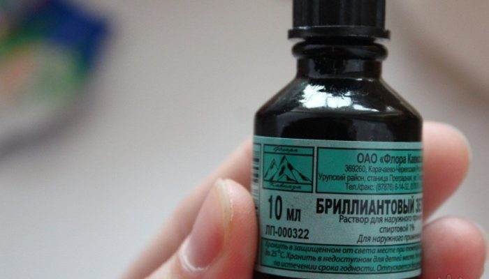 У меня от зеленки на лице ожог