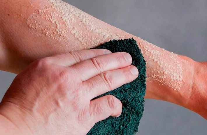 Протирает ожог спиртом