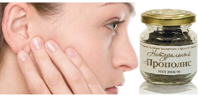 Лечение хронического отита настойкой прополиса