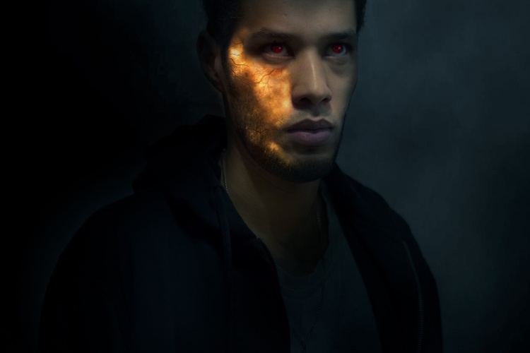 Ожог на руке 3 степени чем лечить