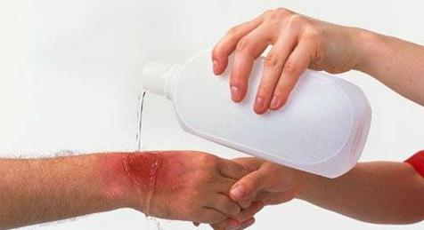 можно ли обрабатывать ожог