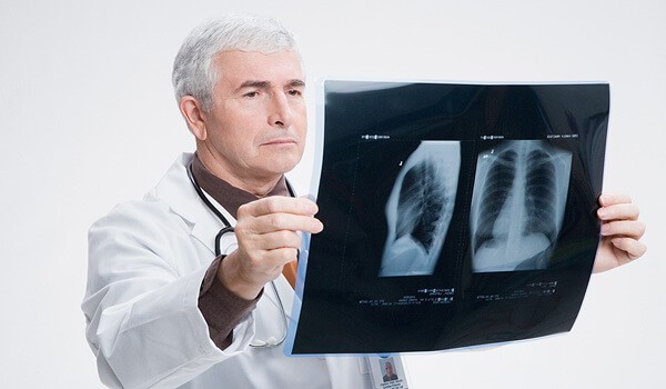 Можно ли вылечить пневмонию без антибиотиков?