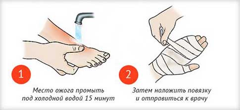 От ожога первая помощь яйцом