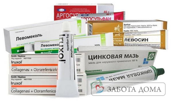 На первой и второй стадия развития, когда пациента беспокоят отек и зуд, специфических врачебных действий не требуется Мази для лечения пролежней