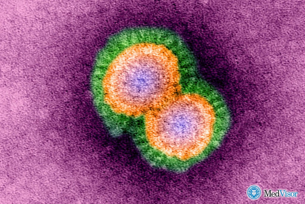 Вирусная пневмония Может ли пневмония протекать без температуры и без кашля