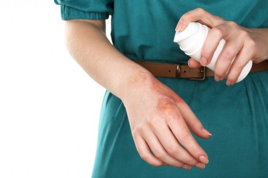 Нанесение антибиотика на ожог Нанесение антибиотика на ожог