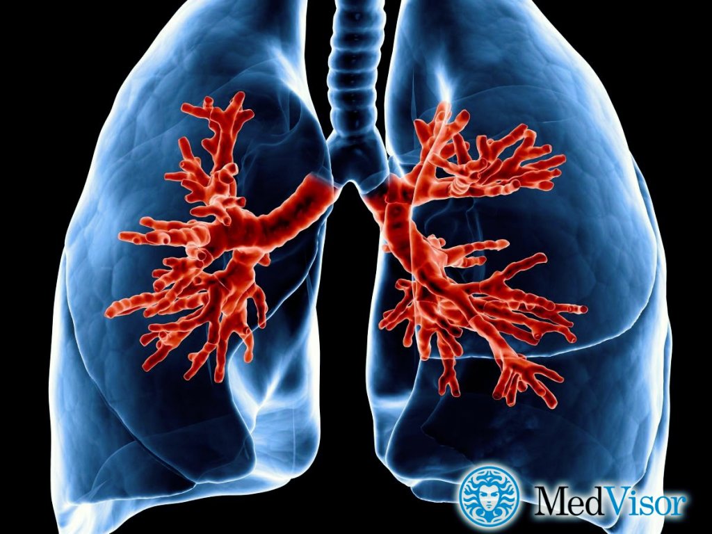 Острый бронхит Как понять что бронхит перешел в пневмонию