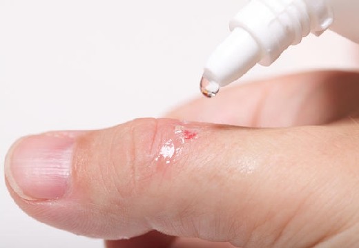 обработка раны