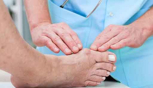 подагра косточка подагра косточка