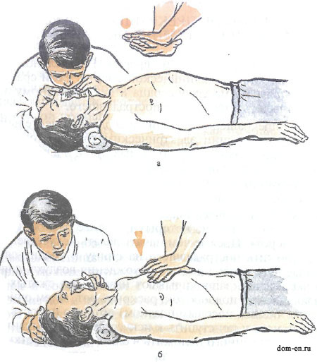 искусственное-дыхание искусственное-дыхание