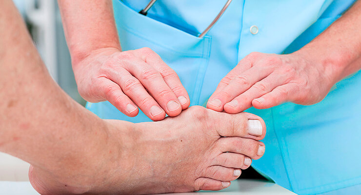 Лечебное питание при подагре - как составить меню и приготовить вкусные блюда Лечебное питание при подагре - как составить меню и приготовить вкусные блюда