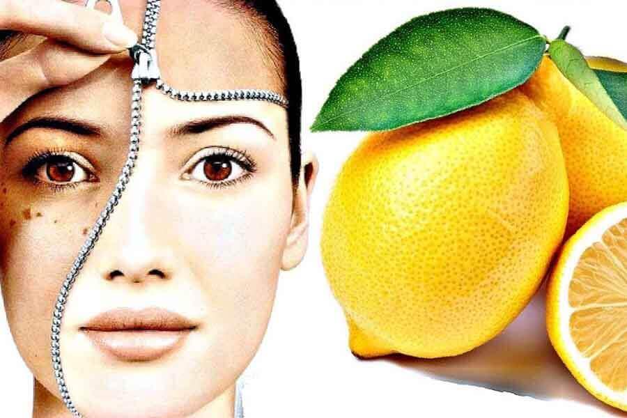 Пигментные пятна после загара