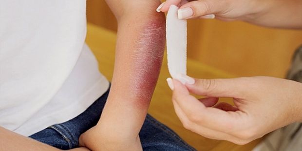 Наложить повязку на рану