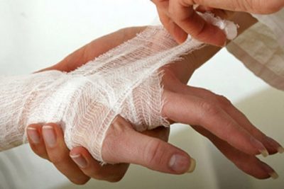 Надо ли прокалывать пузырь после ожога