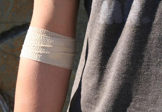 перебинтованный шрам