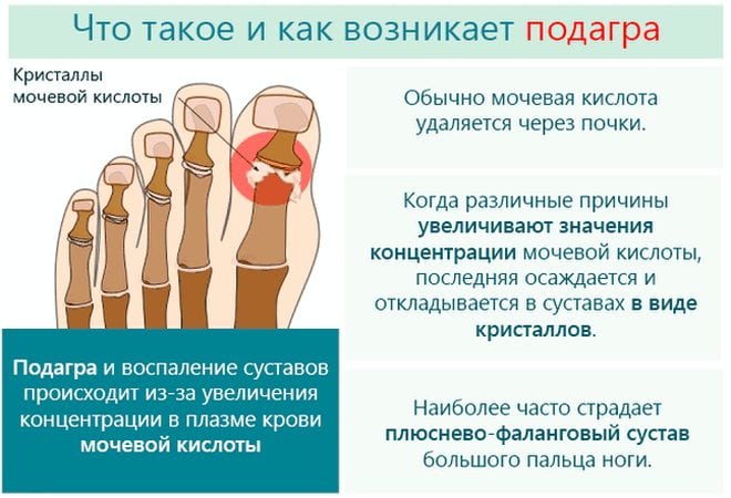 Аллопуринол при подагре механизм действия