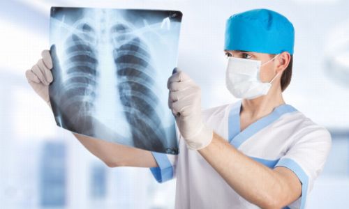 Диагностика аллергической пневмонии на рентгене Диагностика аллергической пневмонии на рентгене