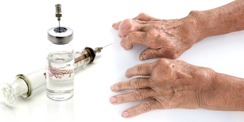 Лечение обострения подагры уколами Лечение обострения подагры уколами