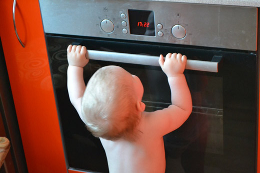 бытовой ожог