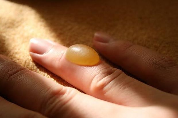 Волдырь от ожога